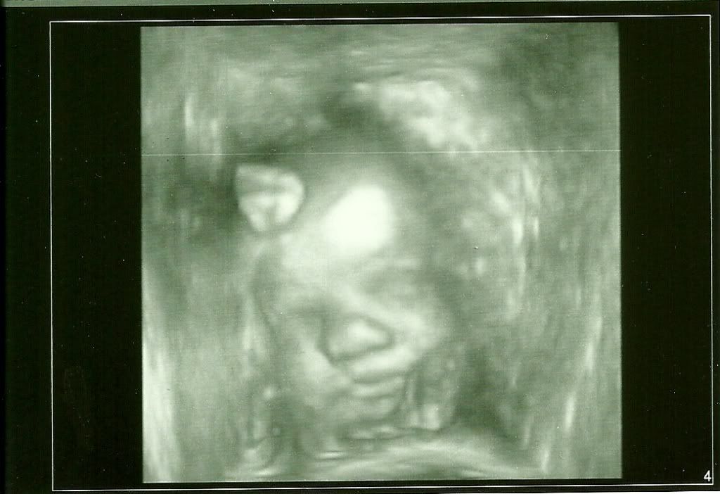 3d ultrasound scan. 2011 3D pregnancy ultrasound and 3d ultrasound scan. girlfriend 3d