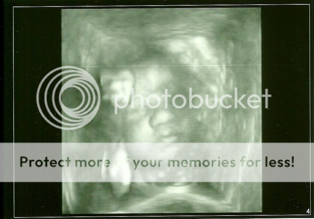 24 weeks pregnant 4d ultrasound